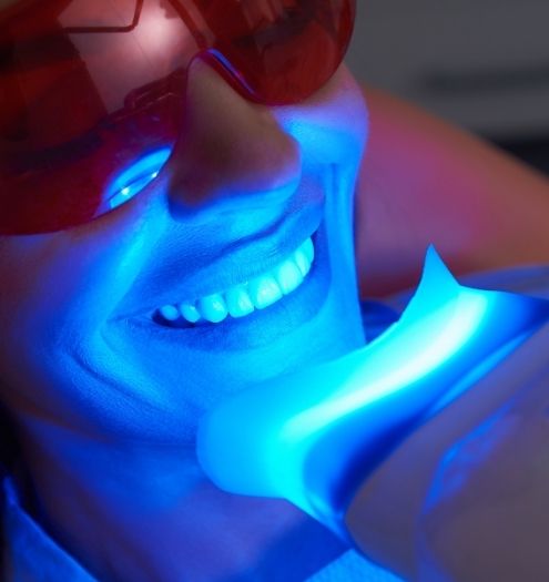 Teeth Whitening
